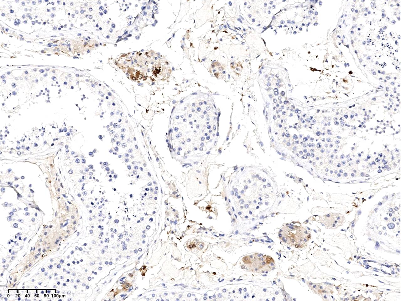 Immunohistochemistry-Paraffin: Kallikrein 15 Antibody (02) - Azide and BSA Free [NBP3-26079] - Immunochemical staining of human Kallikrein 15 in human testis with NBP3-26079 at 1:200 dilution, formalin-fixed paraffin embedded sections.