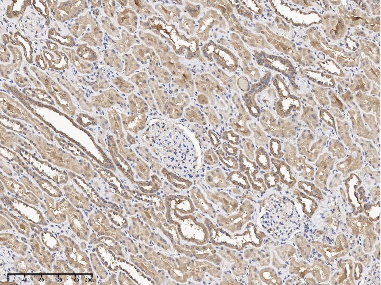 Immunohistochemistry-Paraffin: FIGNL1 Antibody - Azide and BSA Free [NBP3-26083] - Immunochemical staining of human FIGNL1 in human kidney with NBP3-26083 at 1:100 dilution, formalin-fixed paraffin embedded sections.