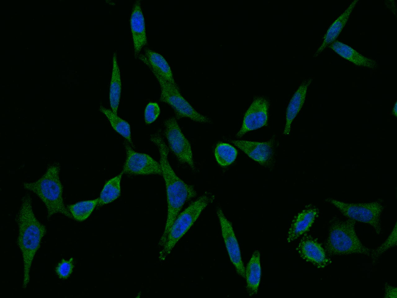 Immunocytochemistry/ Immunofluorescence: Adenylosuccinate Lyase Antibody (05) - Azide and BSA Free [NBP3-26085] - Immunofluorescence staining of Adenylosuccinate Lyase in HeLa cells. Cells were fixed with 4% PFA, permeabilzed with 0.1% Triton X-100 in PBS, blocked with 10% serum, and incubated with NBP3-26085 (dilution ratio 1:60) at 4C overnight. Then cells were stained with the Goat Anti-mouse IgG secondary antibody [Alexa Fluor 488] (green) and counterstained with DAPI (blue). Positive staining was localized to Cytoplasm.