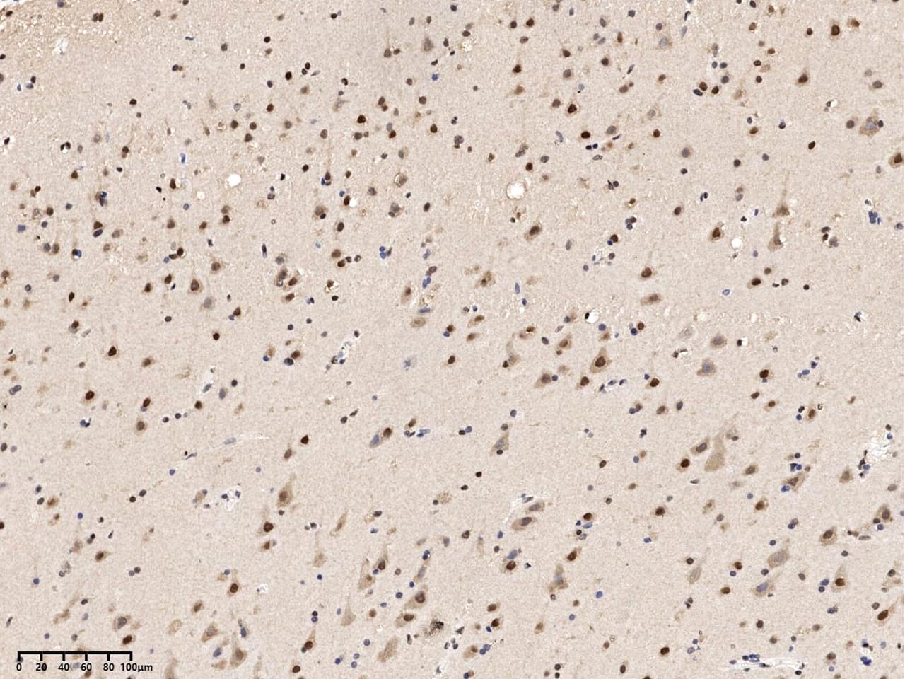Immunohistochemistry-Paraffin: FAM119B Antibody - Azide and BSA Free [NBP3-26094] - Immunochemical staining of human FAM119B in human brain with NBP3-26094 at 1:100-1:5000 dilution, formalin-fixed paraffin embedded sections.