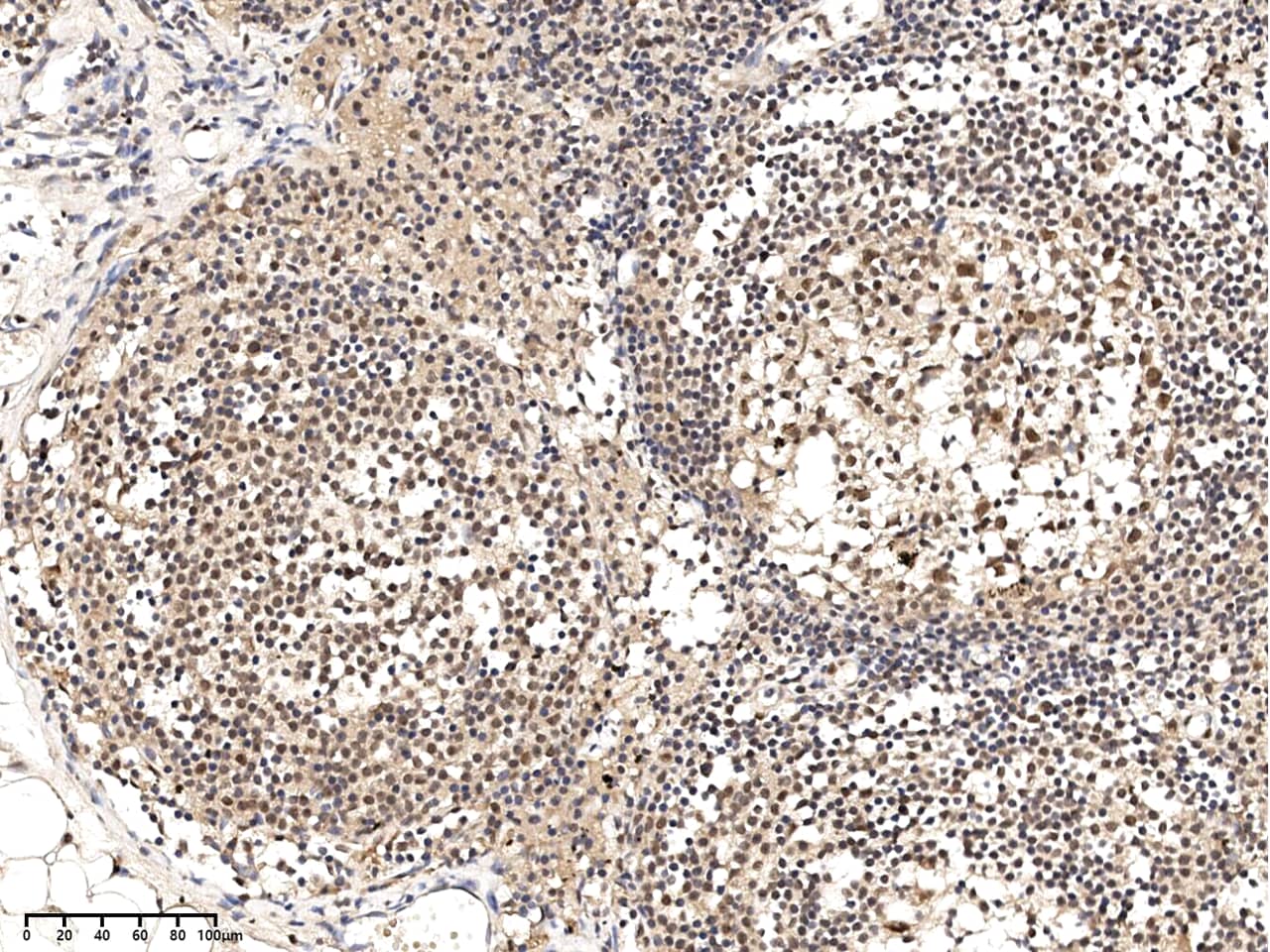 Immunohistochemistry-Paraffin: FAM119B Antibody - Azide and BSA Free [NBP3-26094] - Immunochemical staining of human FAM119B in human lymph node with NBP3-26094 at 1:100-1:5000 dilution, formalin-fixed paraffin embedded sections.