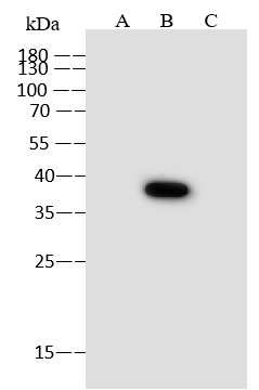 Western Blot: EBOV VP40 protein Antibody (08) - (Sudan/Gulu) - Azide and BSA Free [NBP3-26102] - NBP3-26102 at 1:1000 dilution. Sample: Recombinant Protein 10 ng. Lane A: EBOV (subtype Zaire, strain H.sapiens-wt/GIN/2014/Kissidougou-C15) VP40 protein. Lane B: EBOV (subtype Sudan, strain Gulu) VP40 protein. Lane C: EBOV (subtype Bundibugyo, strain Uganda 2007) VP40 protein. Secondary Goat Anti-Mouse IgG (H+L) [HRP] at 1/10000 dilution. Developed using the ECL technique. Performed under reducing conditions.