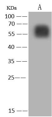 Western Blot: Monkeypox Virus B21R Antibody - Azide and BSA Free [NBP3-26105] - NBP3-26105 at 1:5000 dilution. Lane A: OVA conjugated Monkeypox Virus B21R peptide, 5ng. Secondary Goat Anti-Rabbit IgG (H+L) [HRP] at 1/10000 dilution. Developed using the ECL technique. Performed under reducing conditions.