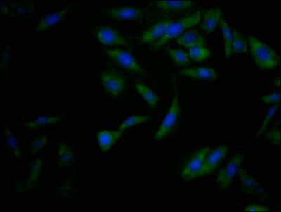 Immunocytochemistry/Immunofluorescence: Nrf2 Antibody (2D12) [NBP3-26113] - Staining of Hela Cells with Nrf2 Antibody (2D12) at 1:50, counter-stained with DAPI. The cells were fixed in 4% formaldehyde, permeated by 0.2% Triton X-100, and blocked in 10% normal Goat Serum. The cells were then incubated with the antibody overnight at 4C. Nuclear DNA was labeled in blue with DAPI. The secondary antibody was FITC-conjugated Goat Anti-Rabbit IgG (H+L).