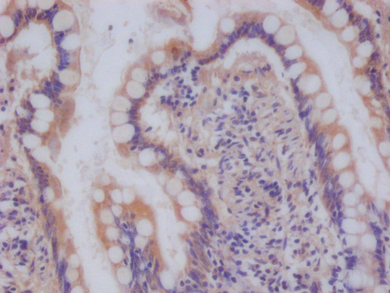 Immunohistochemistry: Ndufs4 Antibody (9H1) [NBP3-26116] - Image of Ndufs4 Antibody (9H1) diluted at 1:100 and staining in paraffin-embedded human small intestine tissue performed. After dewaxing and hydration, antigen retrieval was mediated by high pressure in a citrate buffer (pH 6.0). Section was blocked with 10% normal goat serum 30min at RT. Then primary antibody (1% BSA) was incubated at 4°C overnight. The primary is detected by a Goat anti-rabbit polymer IgG labeled by HRP and visualized using 0.05% DAB.