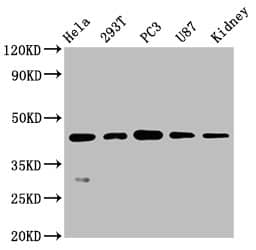 Western Blot: NDRG1 Antibody (4C8) [NBP3-26118] - Positive Western Blot detected in: Hela whole cell lysate, 293T whole cell lysate, PC3 whole cell lysate, U87 whole cell lysate, Mouse kidney tissue. All lanes: NDRG1 Antibody at 0.7ug/ml. Secondary: Goat polyclonal to rabbit IgG at 1/50000 dilution. Predicted band size: 43, 36, 34 KDa Observed band size: 43 KDa