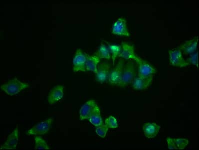 Immunocytochemistry/Immunofluorescence: NDRG1 Antibody (4C8) [NBP3-26118] - Staining of Hela cells with NDRG1 Antibody (4C8) at 1:23, counter-stained with DAPI. The cells were fixed in 4% formaldehyde, permeabilized using 0.2% Triton X-100 and blocked in 10% normal Goat Serum. The cells were then incubated with the antibody overnight at 4C. The secondary antibody was Alexa Fluor 488-conjugated Goat Anti-Rabbit IgG (H+L).