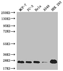 Western Blot: M-Ras/R-Ras3 Antibody (18E11) [NBP3-26129] - Positive Western Blot detected in: MCF-7 whole cell lysate, PC3 whole cell lysate, Hela whole cell lysate, A549 whole cell lysate, HEK293 whole cell lysate. All lanes: M-Ras/R-Ras3 Antibody at 1: 1000 Secondary: Goat polyclonal to rabbit IgG at 1/50000 dilution. Predicted band size: 24, 16 kDa Observed band size: 24 kDa