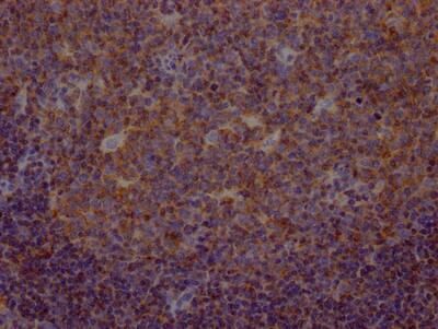 Immunohistochemistry: Methionine Aminopeptidase 2/METAP2 Antibody (8F2) [NBP3-26144] - Image of Methionine Aminopeptidase 2/METAP2 Antibody (8F2) diluted at 1:100 and staining in paraffin-embedded human tonsil tissue performed. After dewaxing and hydration, antigen retrieval was mediated by high pressure in a citrate buffer (pH 6.0). Section was blocked with 10% normal goat serum 30min at RT. Then primary antibody (1% BSA) was incubated at 4C overnight. The primary is detected by a Goat anti-rabbit IgG polymer labeled by HRP and visualized using 0.05% DAB.