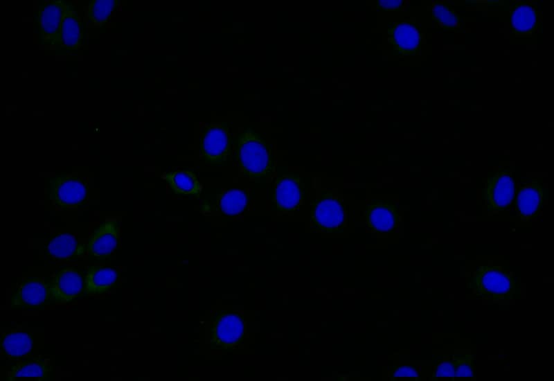 Immunocytochemistry/Immunofluorescence: LYVE-1 Antibody (11C11) [NBP3-26159] - Staining of HepG2 with LYVE-1 Antibody (11C11) at 1:25, counter-stained with DAPI. The cells were fixed in 4% formaldehyde and blocked in 10% normal Goat Serum. The cells were then incubated with the antibody overnight at 4C. The secondary antibody was Alexa Fluor 505-conjugated Goat Anti-Rabbit IgG (H+L).