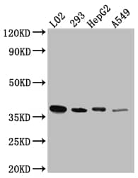 Western Blot: LRG1 Antibody (7A1) [NBP3-26164] - Positive Western Blot detected in: L02 whole cell lysate, HEK293 whole cell lysate, HepG2 whole cell lysate, A549 whole cell lysate. All lanes: LRG1 Antibody at 1: 1000 Secondary: Goat polyclonal to rabbit IgG at 1/50000 dilution. Predicted band size: 39 kDa Observed band size: 39 kDa