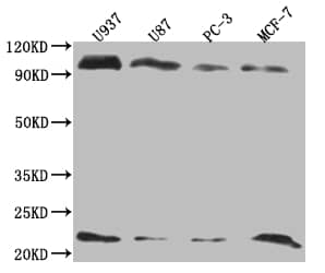 Western Blot: LMO2 Antibody (9H9) [NBP3-26166] - Positive Western Blot detected in: U937 whole cell lysate, U87 whole cell lysate, PC3 whole cell lysate, MCF-7 whole cell lysate. All lanes: LMO2 Antibody at 1: 2000 Secondary: Goat polyclonal to rabbit IgG at 1/50000 dilution. Predicted band size: 19, 26, 6 kDa Observed band size: 20-25, 90-100 kDa