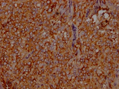 Immunohistochemistry: LDLR Antibody (2B10) [NBP3-26172] - Image of LDLR Antibody (2B10) diluted at 1:100 and staining in paraffin-embedded human adrenal gland tissue performed. After dewaxing and hydration, antigen retrieval was mediated by high pressure in a citrate buffer (pH 6.0). Section was blocked with 10% normal goat serum 30min at RT. Then primary antibody (1% BSA) was incubated at 4C overnight. The primary is detected by a Goat anti-rabbit IgG polymer labeled by HRP and visualized using 0.05% DAB.