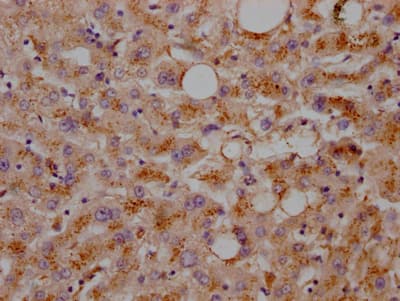 Immunohistochemistry: LDLR Antibody (2B10) [NBP3-26172] - Image of LDLR Antibody (2B10) diluted at 1:100 and staining in paraffin-embedded human adrenal gland tissue performed. After dewaxing and hydration, antigen retrieval was mediated by high pressure in a citrate buffer (pH 6.0). Section was blocked with 10% normal goat serum 30min at RT. Then primary antibody (1% BSA) was incubated at 4C overnight. The primary is detected by a Goat anti-rabbit IgG polymer labeled by HRP and visualized using 0.05% DAB.