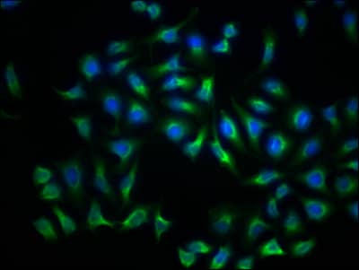 Immunocytochemistry/Immunofluorescence: LDLR Antibody (2B10) [NBP3-26172] - Staining of Hela Cells with LDLR Antibody (2B10) at 1:50, counter-stained with DAPI. The cells were fixed in 4% formaldehyde, permeated by 0.2% Triton X-100, and blocked in 10% normal Goat Serum. The cells were then incubated with the antibody overnight at 4C. Nuclear DNA was labeled in blue with DAPI. The secondary antibody was FITC-conjugated Goat Anti-Rabbit IgG (H+L).