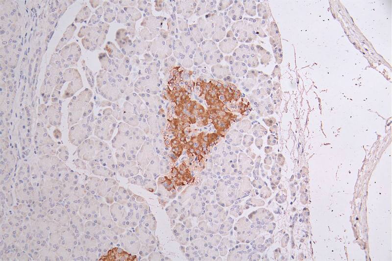 Immunohistochemistry: Cytokeratin 10 Antibody (18B6) [NBP3-26178] - Image of Cytokeratin 10 Antibody (18B6) diluted at 1:50 and staining in paraffin-embedded human pancreati tissue performed. After dewaxing and hydration, antigen retrieval was mediated by high pressure in a citrate buffer (pH 6.0). Section was blocked with 10% normal goat serum 30min at RT. Then primary antibody (1% BSA) was incubated at 4°C overnight. The primary is detected by a Goat anti-rabbit polymer IgG labeled by HRP and visualized using 0.34% DAB.