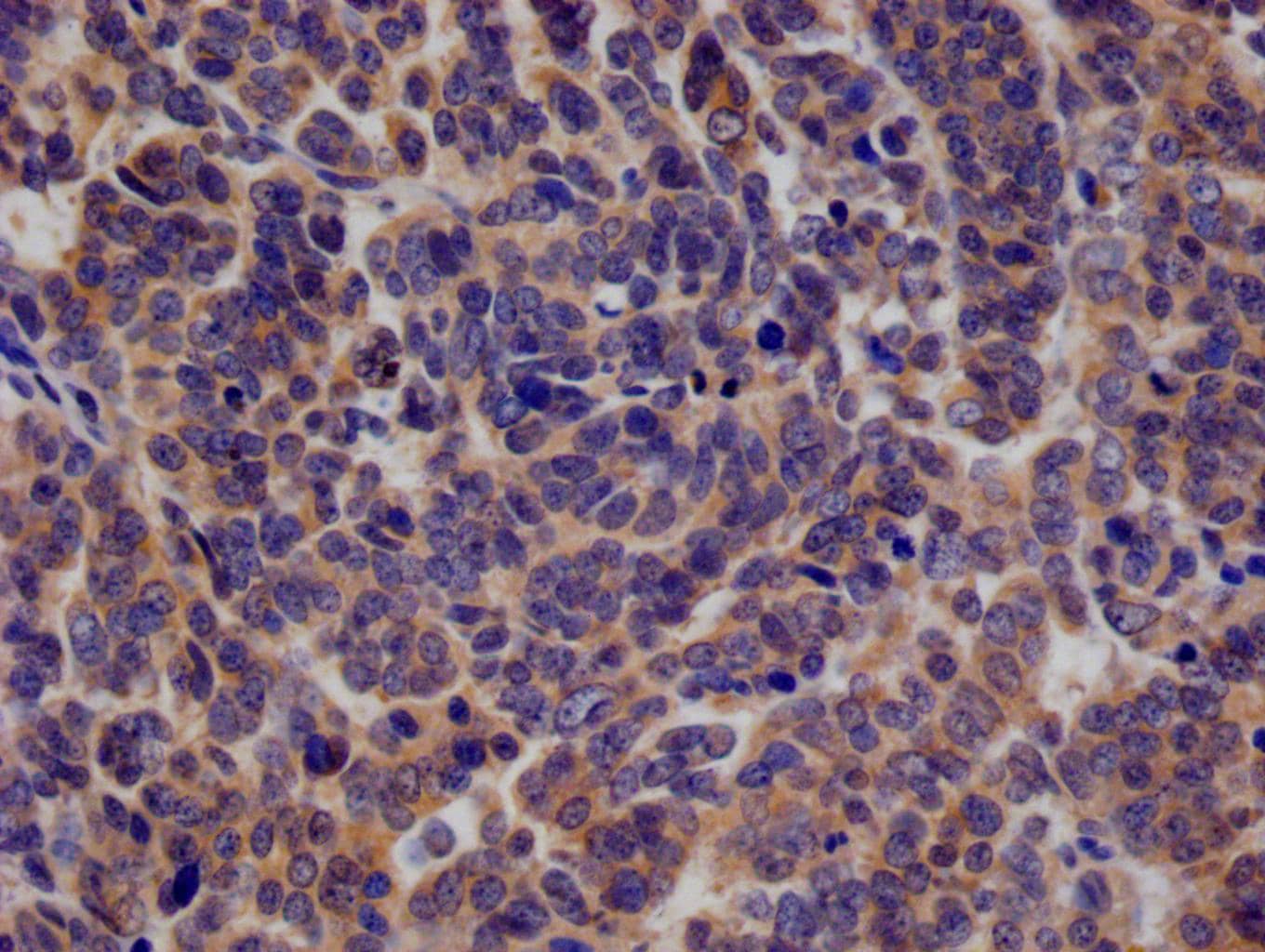 Immunohistochemistry KIFAP3 Antibody (28E9)