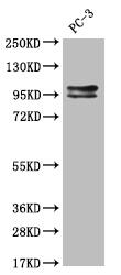 Western Blot: KIFAP3 Antibody (28E9) [NBP3-26181] - Positive Western Blot detected in: Hela whole cell lysate. All lanes: KIFAP3 Antibody at 1: 2000 Secondary: Goat polyclonal to rabbit IgG at 1/50000 dilution. Predicted band size: 92, 87, 83 kDa Observed band size: 72-95 kDa