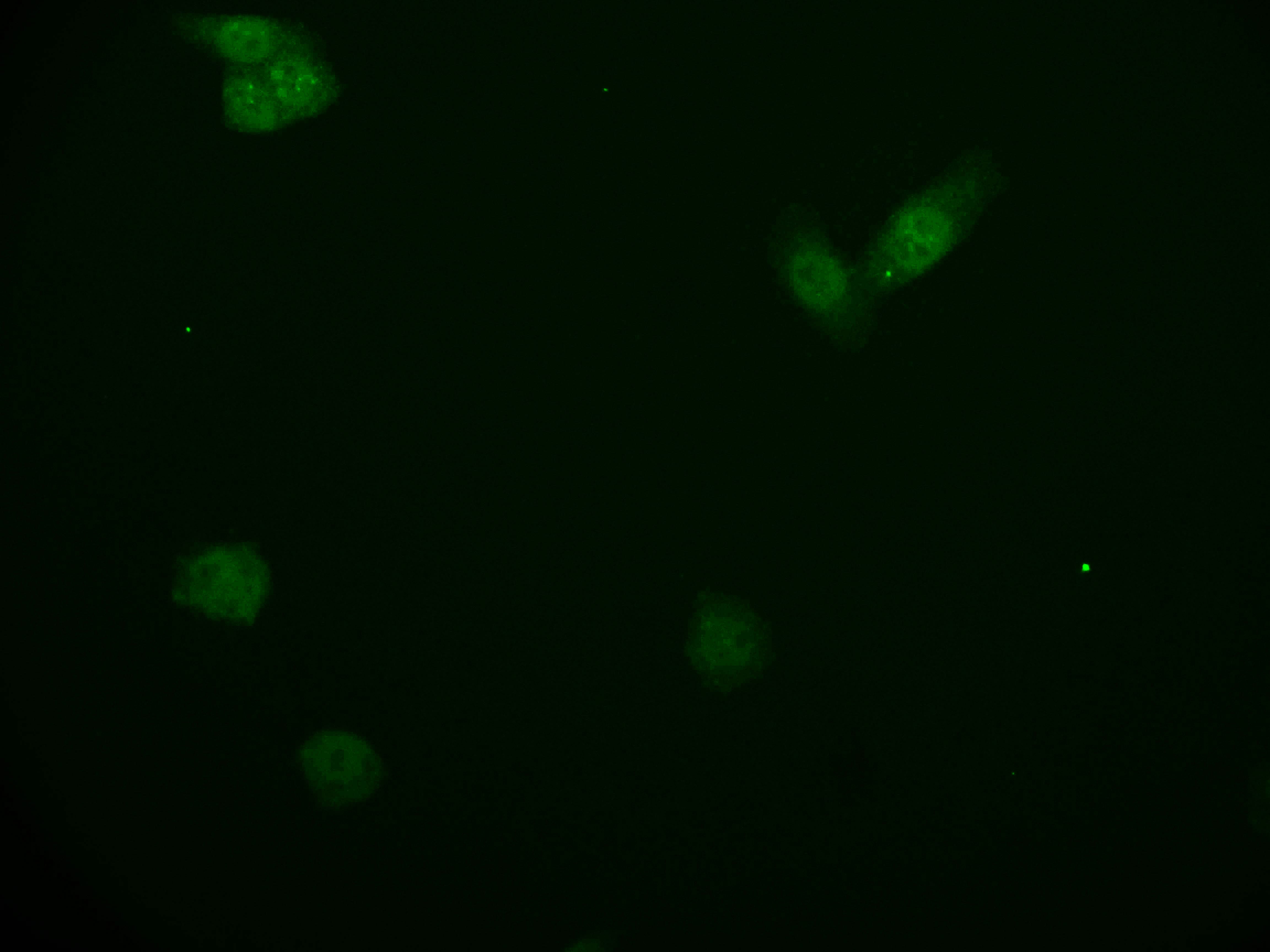 Immunocytochemistry/Immunofluorescence: KIFAP3 Antibody (28E9) [NBP3-26181] - Staining of PC-3 cell with KIFAP3 Antibody (28E9) at 1:50, counter-stained with DAPI. The cells were fixed in 4% formaldehyde and blocked in 10% normal Goat Serum. The cells were then incubated with the antibody overnight at 4C. The secondary antibody was Alexa Fluor 552-conjugated Goat Anti-Rabbit IgG (H+L).