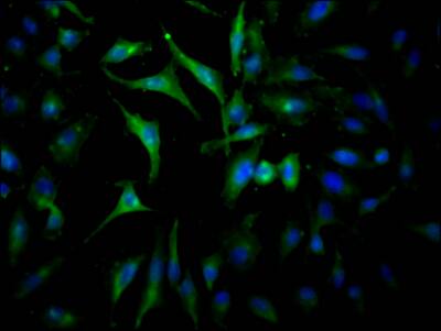 Immunocytochemistry/Immunofluorescence: Jak2 Antibody (10B6) [NBP3-26187] - Staining of Hela Cells with Jak2 Antibody (10B6) at 1:50, counter-stained with DAPI. The cells were fixed in 4% formaldehyde, permeated by 0.2% Triton X-100, and blocked in 10% normal Goat Serum. The cells were then incubated with the antibody overnight at 4C. Nuclear DNA was labeled in blue with DAPI. The secondary antibody was FITC-conjugated Goat Anti-Rabbit IgG (H+L).