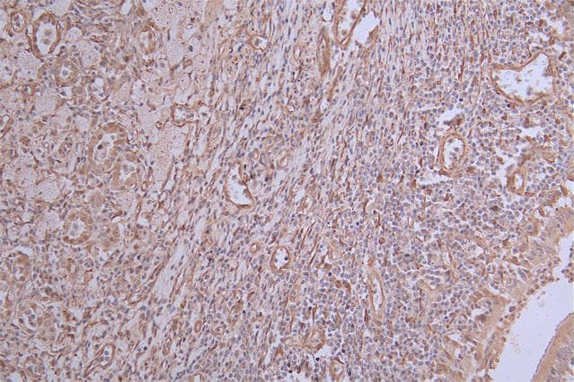 Immunohistochemistry: INMT Antibody (31G7) [NBP3-26197] - Image of INMT Antibody (31G7) diluted at 1:50 and staining in paraffin-embedded human lung tissue performed. After dewaxing and hydration, antigen retrieval was mediated by high pressure in a citrate buffer (pH 6.0). Section was blocked with 10% normal goat serum 30min at RT. Then primary antibody (1% BSA) was incubated at 4°C overnight. The primary is detected by a Goat anti-rabbit polymer IgG labeled by HRP and visualized using 0.24% DAB.