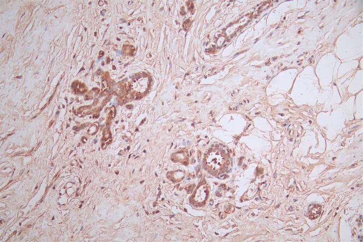 Immunohistochemistry: HSD3B1 Antibody (10G2) [NBP3-26218] - Image of HSD3B1 Antibody (10G2) diluted at 1:100 and staining in paraffin-embedded human placenta tissue performed. After dewaxing and hydration, antigen retrieval was mediated by high pressure in a citrate buffer (pH 6.0). Section was blocked with 10% normal goat serum 30min at RT. Then primary antibody (1% BSA) was incubated at 4°C overnight. The primary is detected by a Goat anti-rabbit polymer IgG labeled by HRP and visualized using 0.50% DAB.