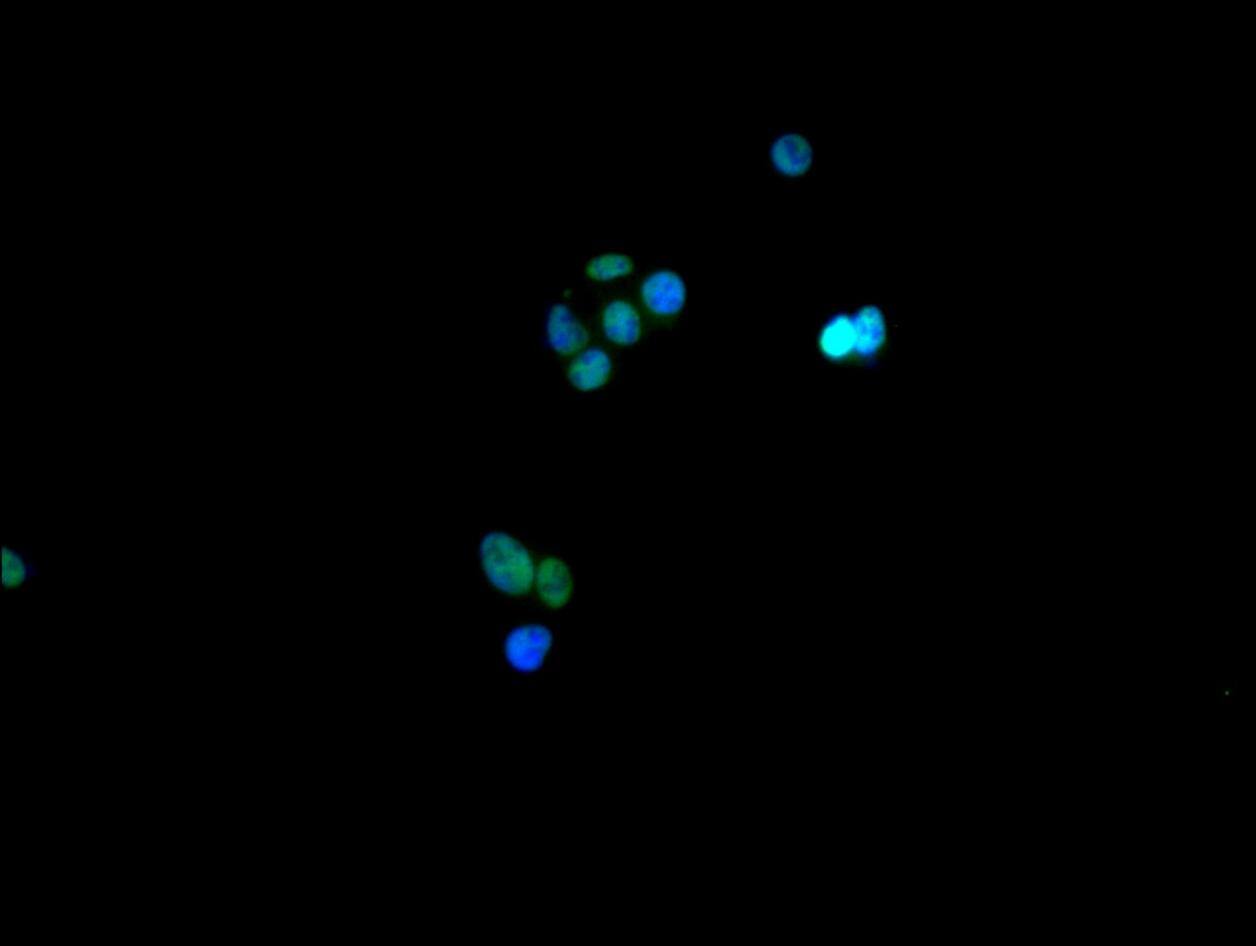 Immunocytochemistry/Immunofluorescence: hnRNP C1 + C2 Antibody (9G1) [NBP3-26221] - Staining of HepG2 cell with NBP3-26221 at 1:30, counter-stained with DAPI. The cells were fixed in 4% formaldehyde and blocked in 10% normal Goat Serum. The cells were then incubated with the antibody overnight at 4C. The secondary antibody was Alexa Fluor 488-congugated AffiniPure Goat Anti-Rabbit IgG (H+L).