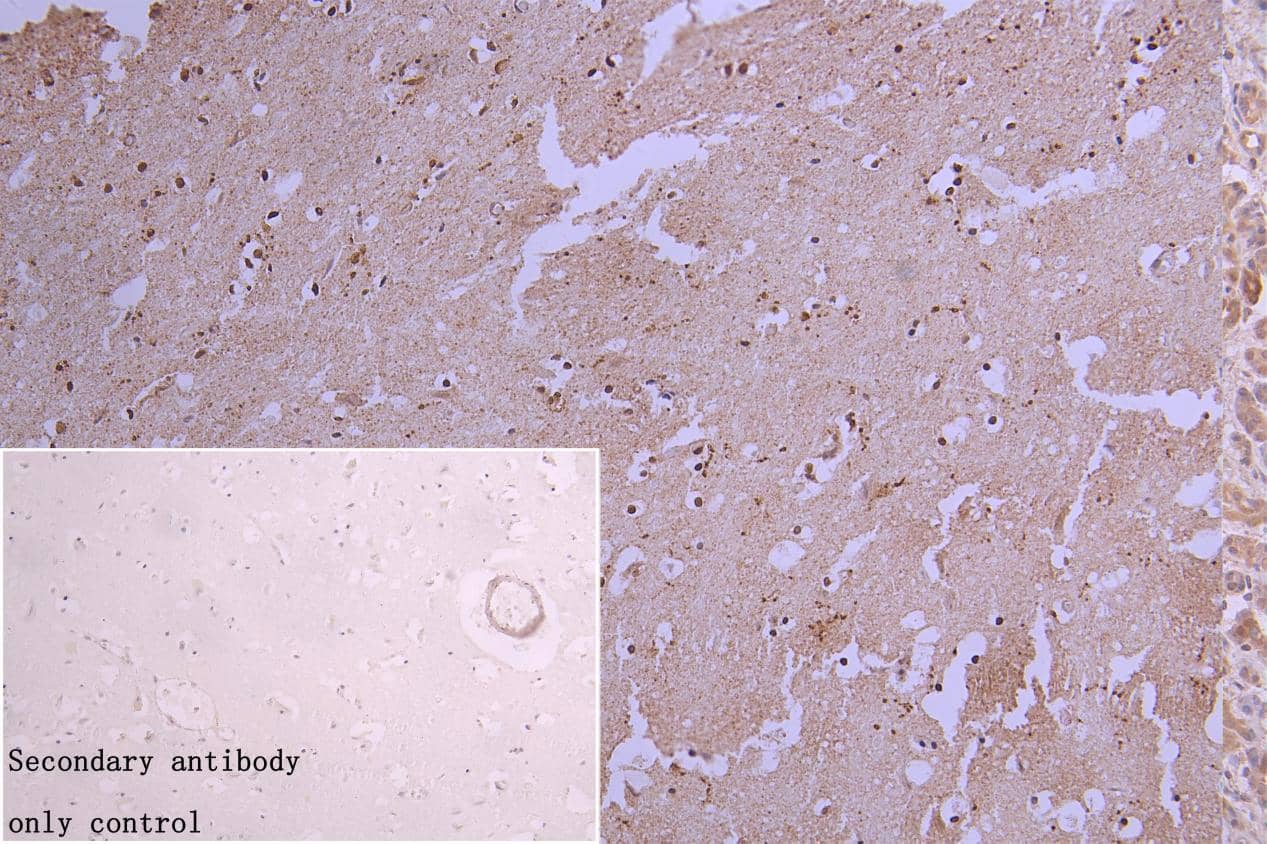 Immunohistochemistry: hnRNP C1 + C2 Antibody (9G1) [NBP3-26221] - NBP3-26221 diluted  at  1:300  and  staining  in  paraffin-embedded  human  braintissue  performed  on  a  Leica  BondTM  system.  After  dewaxing  and  hydration,  antigen  retrieval  was  mediated  by  high  pressure  in  a  citrate  buffer  (pH  6.0).  Section  was  blocked  with  10%  normal  goat  serum  30min  at  RT.  Then  primary  antibody  (1%  BSA)  was  incubated  at  4°C  overnight.  The  primary  is  detected  by  a  Goat  anti-rabbit  polymer  IgG  labeled  by  HRP  and  visualized  using  0.05%  DAB.Secondary  antibody  only  control: uses 1%  BSA instead of primary antibody