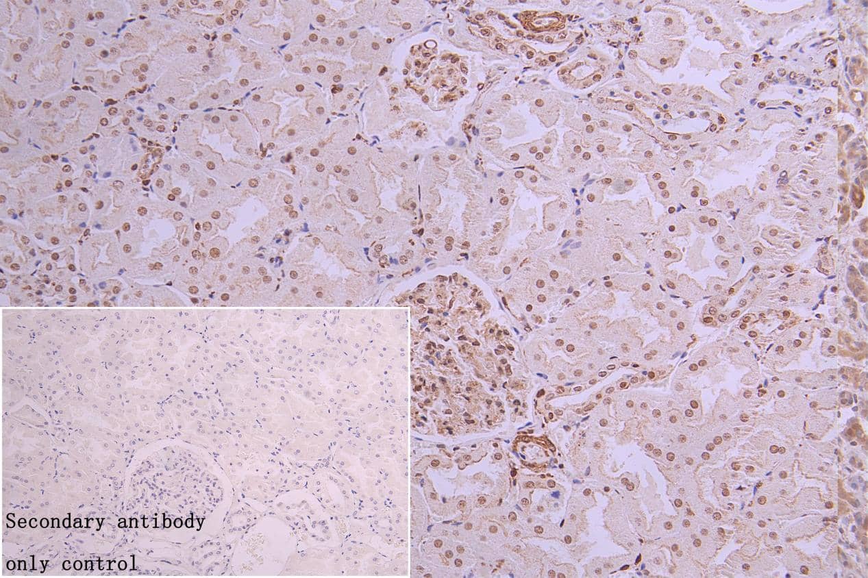 Immunohistochemistry: hnRNP C1 + C2 Antibody (9G1) [NBP3-26221] - NBP3-26221 diluted at 1:300 and staining in paraffin-embedded human kidney tissue performed on a Leica BondTM system. After dewaxing and hydration, antigen retrieval was mediated by high pressure in a citrate buffer (pH 6.0). Section was blocked with 10% normal goat serum 30min at RT. Then primary antibody (1% BSA) was incubated at 4°C overnight. The primary is detected by a Goat anti-rabbit polymer IgG labeled by HRP and visualized using 0.05% DAB.Secondary antibody only control: uses 1% BSA instead of primary antibody