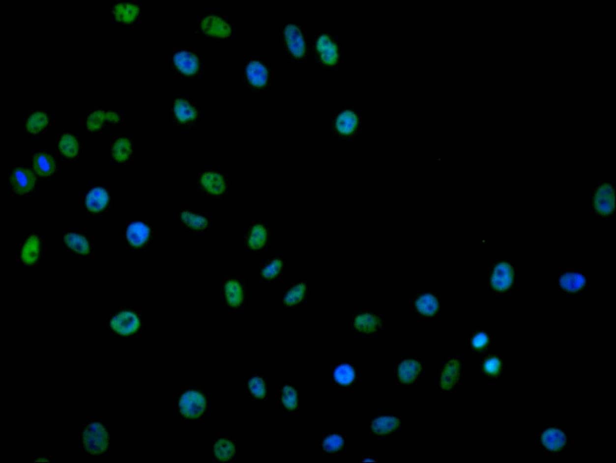 Immunocytochemistry/Immunofluorescence: hnRNP C1 + C2 Antibody (9G1) [NBP3-26221] - Staining of Hela cell with NBP3-26221 at 1:30, counter-stained with DAPI. The cells were fixed in 4% formaldehyde and blocked in 10% normal Goat Serum. The cells were then incubated with the antibody overnight at 4C. The secondary antibody was Alexa Fluor 488-congugated AffiniPure Goat Anti-Rabbit IgG (H+L).