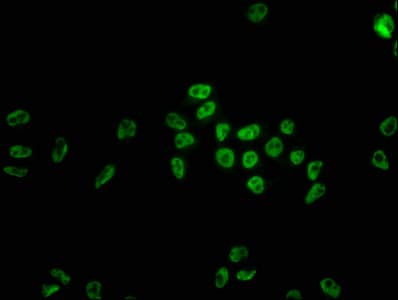 Immunocytochemistry/Immunofluorescence: hnRNP C1 + C2 Antibody (9G1) [NBP3-26221] - Staining of Hela cells with hnRNP C1 + C2 Antibody (9G1) at 1:22, counter-stained with DAPI. The cells were fixed in 4% formaldehyde, permeabilized using 0.2% Triton X-100 and blocked in 10% normal Goat Serum. The cells were then incubated with the antibody overnight at 4C. The secondary antibody was Alexa Fluor 488-conjugated Goat Anti-Rabbit IgG (H+L).