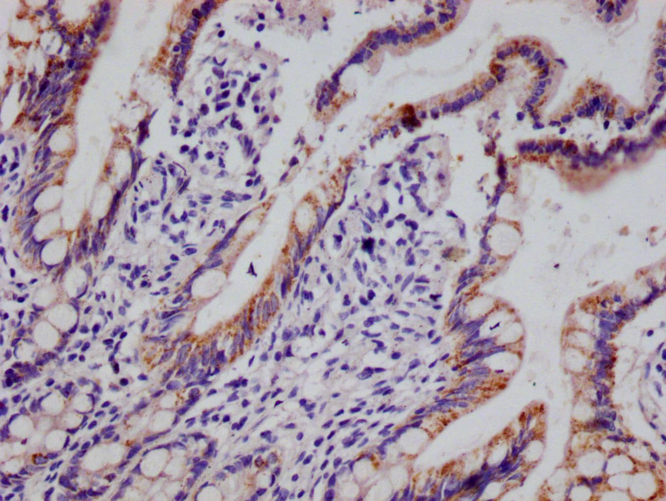 Immunohistochemistry: HMGCS2 Antibody (19C11) [NBP3-26223] - Image of HMGCS2 Antibody (19C11) diluted at 1:100 and staining in paraffin-embedded human small intestine tissue performed. After dewaxing and hydration, antigen retrieval was mediated by high pressure in a citrate buffer (pH 6.0). Section was blocked with 10% normal goat serum 30min at RT. Then primary antibody (1% BSA) was incubated at 4°C overnight. The primary is detected by a Goat anti-rabbit polymer IgG labeled by HRP and visualized using 0.05% DAB.