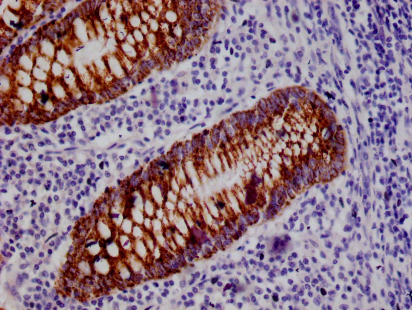 Immunohistochemistry: HMGCS2 Antibody (19C11) [NBP3-26223] - Image of HMGCS2 Antibody (19C11) diluted at 1:100 and staining in paraffin-embedded human small intestine tissue performed. After dewaxing and hydration, antigen retrieval was mediated by high pressure in a citrate buffer (pH 6.0). Section was blocked with 10% normal goat serum 30min at RT. Then primary antibody (1% BSA) was incubated at 4°C overnight. The primary is detected by a Goat anti-rabbit polymer IgG labeled by HRP and visualized using 0.05% DAB.