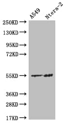 Western Blot: HMGCS2 Antibody (19C11) [NBP3-26223] - Positive Western Blot detected in: A549 whole cell lysate, Ntera-2 whole cell lysate. All lanes: HMGCS2 Antibody at 1: 500 Secondary: Goat polyclonal to rabbit IgG at 1/50000 dilution. Predicted band size: 57, 53, 51 kDa Observed band size: 55 kDa