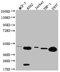 Western Blot: HMBS Antibody (8G12) [NBP3-26225] - Positive Western Blot detected in: MCF-7 whole cell lysate, K562 whole cell lysate, Jurkat whole cell lysate, THP-1 whole cell lysate, U937 whole cell lysate. All lanes: HMBS Antibody at 1: 2000 Secondary: Goat polyclonal to rabbit IgG at 1/50000 dilution. Predicted band size: 40, 38, 35, 34kDa Observed band size: 36-55 kDa