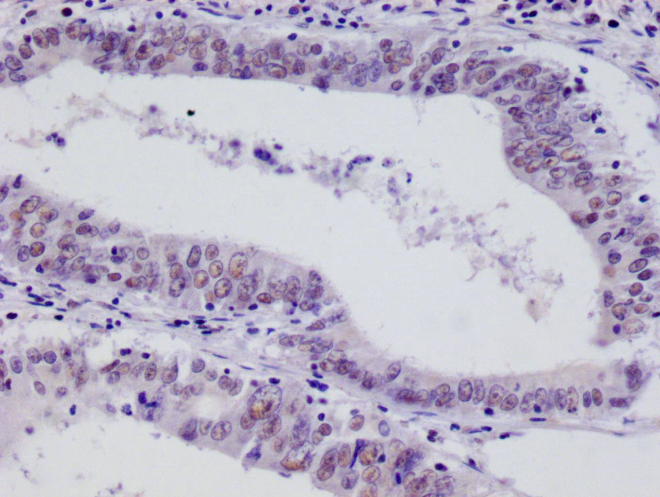 Immunohistochemistry: FIH-1/HIF-1AN Antibody (12F11) [NBP3-26233] - Image of FIH-1/HIF-1AN Antibody (12F11) diluted at 1:100 and staining in paraffin-embedded human testis tissue performed. After dewaxing and hydration, antigen retrieval was mediated by high pressure in a citrate buffer (pH 6.0). Section was blocked with 10% normal goat serum 30min at RT. Then primary antibody (1% BSA) was incubated at 4C overnight. The primary is detected by a Goat anti-rabbit polymer IgG labeled by HRP and visualized using 0.05% DAB.