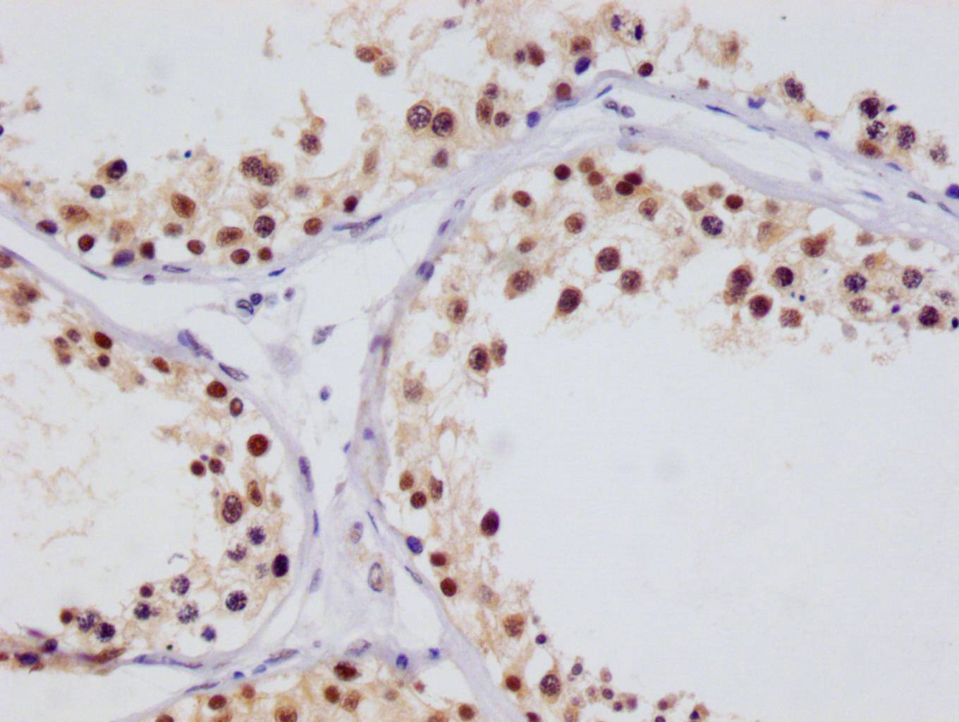 Immunohistochemistry: FIH-1/HIF-1AN Antibody (12F11) [NBP3-26233] - Image of FIH-1/HIF-1AN Antibody (12F11) diluted at 1:100 and staining in paraffin-embedded human testis tissue performed. After dewaxing and hydration, antigen retrieval was mediated by high pressure in a citrate buffer (pH 6.0). Section was blocked with 10% normal goat serum 30min at RT. Then primary antibody (1% BSA) was incubated at 4°C overnight. The primary is detected by a Goat anti-rabbit polymer IgG labeled by HRP and visualized using 0.05% DAB.