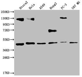 Western Blot: FIH-1/HIF-1AN Antibody (12F11) [NBP3-26233] - Positive Western Blot detected in: Ntera-2 whole cell lysate, Hela whole cell lysate, A549 whole cell lysate, HepG2 whole cell lysate, PC3 whole cell lysate, U87 whole cell lysate. All lanes: FIH-1/HIF-1AN Antibody at 1: 2000 Secondary: Goat polyclonal to rabbit IgG at 1/50000 dilution. Predicted band size: 41 kDa Observed band size: 36-53 kDa