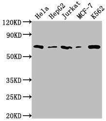 Western Blot: Histone Deacetylase 2/HDAC2 Antibody (9E9) [NBP3-26238] - Positive Western Blot detected in: Hela whole cell lysate, HepG2 whole cell lysate, Jurkat whole cell lysate, MCF-7 whole cell lysate, K562 whole cell lysate. All lanes: Histone Deacetylase 2/HDAC2 Antibody at 1: 2000 Secondary: Goat polyclonal to rabbit IgG at 1/50000 dilution. Predicted band size: 56, 52 kDa Observed band size: 60 kDa