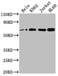 Western Blot: HDAC1 Antibody (10A1) [NBP3-26240] - Positive Western Blot detected in: Hela whole cell lysate, K562 whole cell lysate, Jurkat whole cell lysate, HL60 whole cell lysate. All lanes: HDAC1 Antibody at 1: 2000 Secondary: Goat polyclonal to rabbit IgG at 1/50000 dilution. Predicted band size: 56 kDa Observed band size: 60 kDa