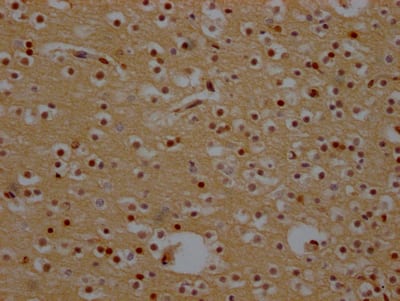 Immunohistochemistry: CRM1 Antibody (9F2) [NBP3-26249] - Image of CRM1 Antibody (9F2) diluted at 1:100 and staining in paraffin-embedded human ovarian tissue performed. After dewaxing and hydration, antigen retrieval was mediated by high pressure in a citrate buffer (pH 6.0). Section was blocked with 10% normal goat serum 30min at RT. Then primary antibody (1% BSA) was incubated at 4C overnight. The primary is detected by a Goat anti-rabbit IgG polymer labeled by HRP and visualized using 0.05% DAB.