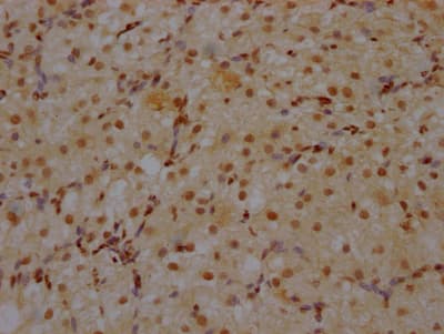 Immunohistochemistry: CRM1 Antibody (9F2) [NBP3-26249] - Image of CRM1 Antibody (9F2) diluted at 1:100 and staining in paraffin-embedded human ovarian tissue performed. After dewaxing and hydration, antigen retrieval was mediated by high pressure in a citrate buffer (pH 6.0). Section was blocked with 10% normal goat serum 30min at RT. Then primary antibody (1% BSA) was incubated at 4C overnight. The primary is detected by a Goat anti-rabbit IgG polymer labeled by HRP and visualized using 0.05% DAB.