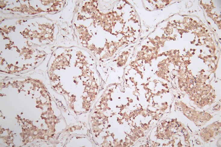 Immunohistochemistry: WDR5 Antibody (18D11) [NBP3-26253] - Image of WDR5 Antibody (18D11) diluted at 1:50 and staining in paraffin-embedded human testis tissue performed. After dewaxing and hydration, antigen retrieval was mediated by high pressure in a citrate buffer (pH 6.0). Section was blocked with 10% normal goat serum 30min at RT. Then primary antibody (1% BSA) was incubated at 4C overnight. The primary is detected by a Goat anti-rabbit polymer IgG labeled by HRP and visualized using 0.79% DAB.