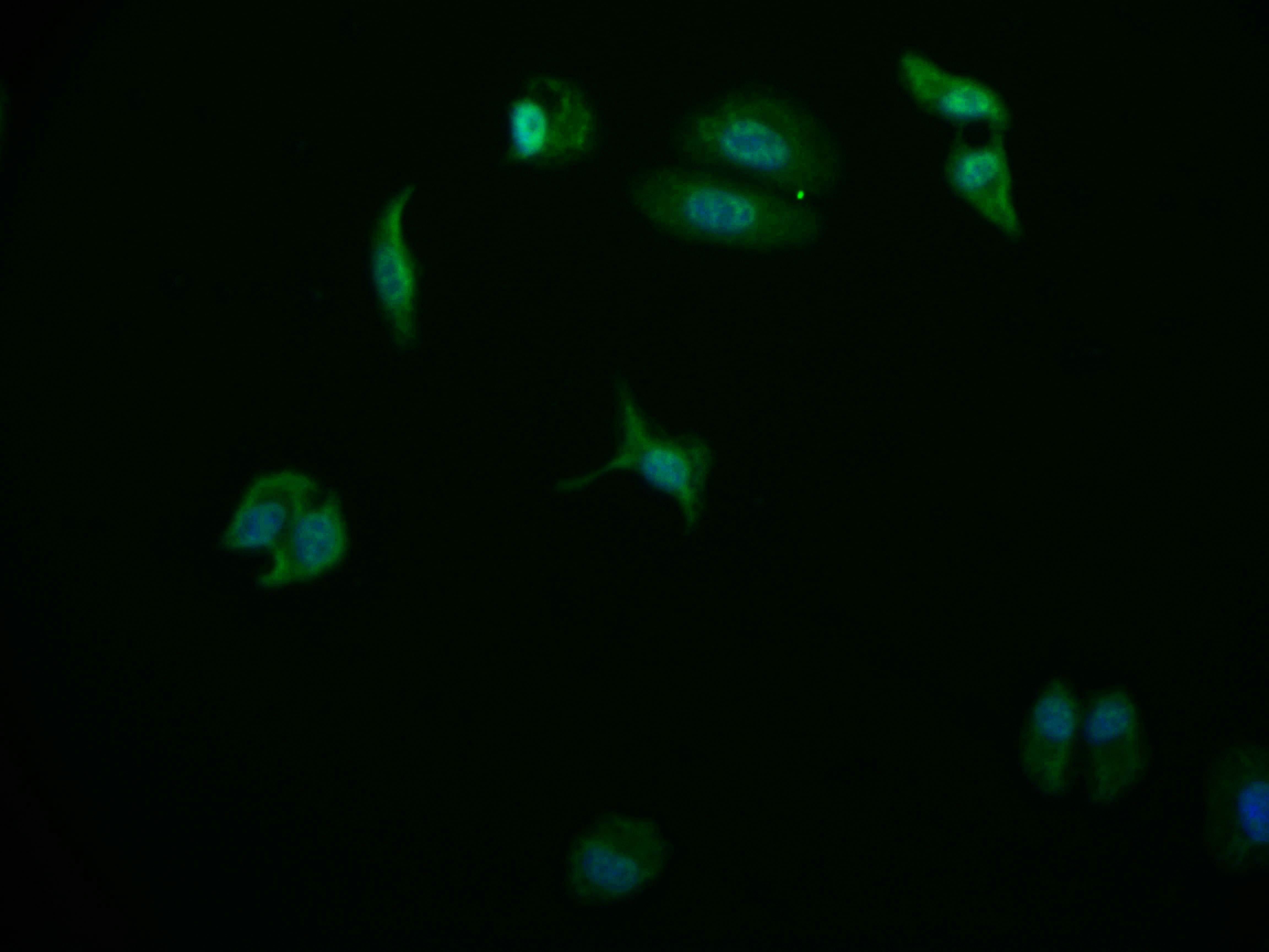 Immunocytochemistry/Immunofluorescence: USP24 Antibody (11E3) [NBP3-26259] - Staining of HepG2 cell with USP24 Antibody (11E3) at 1:50, counter-stained with DAPI. The cells were fixed in 4% formaldehyde and blocked in 10% normal Goat Serum. The cells were then incubated with the antibody overnight at 4C. The secondary antibody was Alexa Fluor 569-conjugated Goat Anti-Rabbit IgG (H+L).