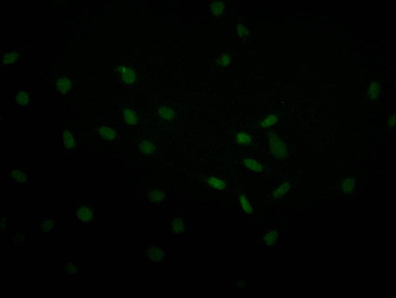 Immunocytochemistry/Immunofluorescence: USP22 Antibody (18E3) [NBP3-26260] - Staining of MCF-7 with USP22 Antibody (18E3) at 1:30, counter-stained with DAPI. The cells were fixed in 4% formaldehyde and blocked in 10% normal Goat Serum. The cells were then incubated with the antibody overnight at 4C. The secondary antibody was Alexa Fluor 493-conjugated Goat Anti-Rabbit IgG (H+L).