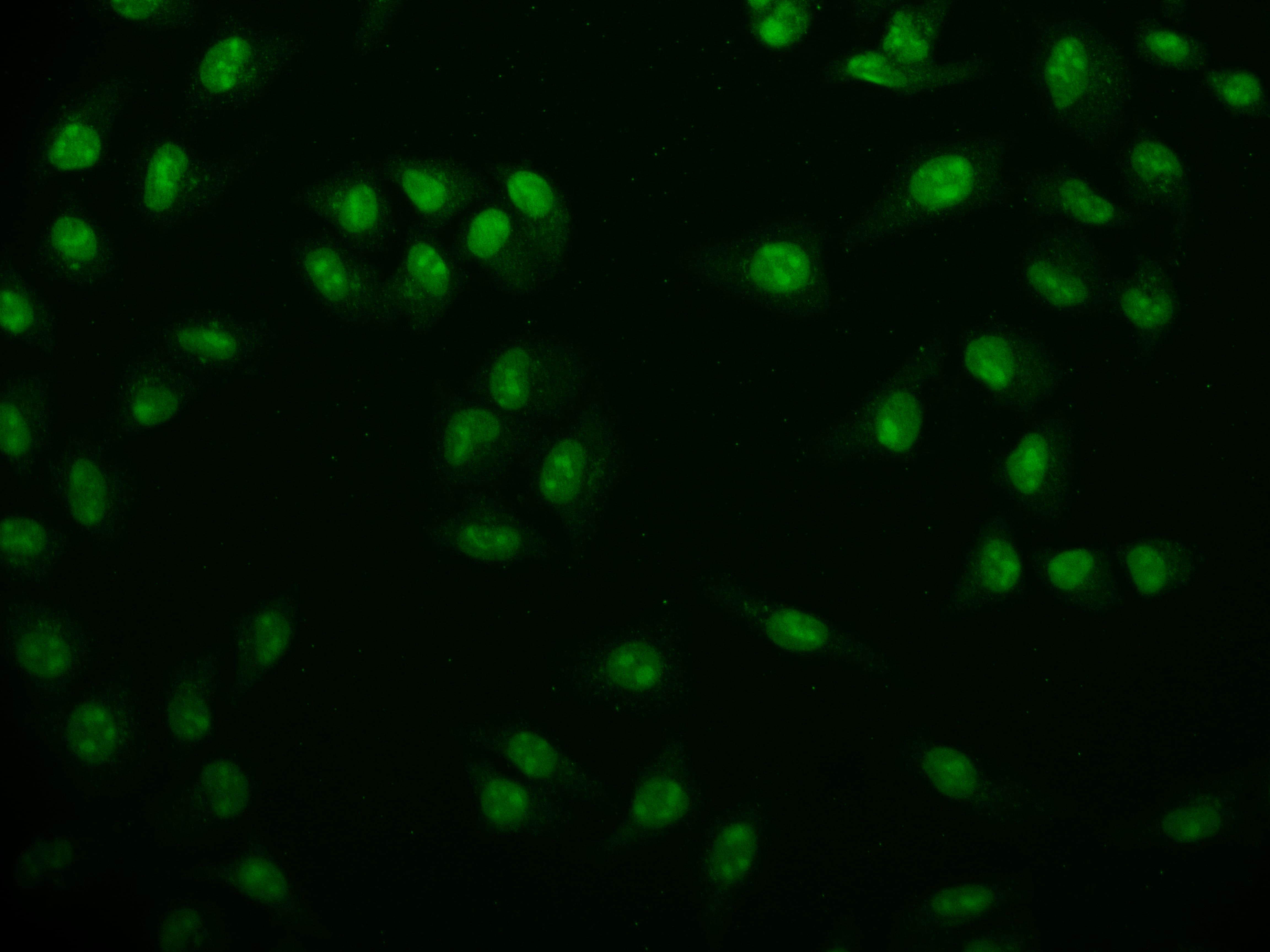 Immunocytochemistry/Immunofluorescence: USP22 Antibody (18H6) [NBP3-26261] - Staining of Hela cell with USP22 Antibody (18H6) at 1:50, counter-stained with DAPI. The cells were fixed in 4% formaldehyde and blocked in 10% normal Goat Serum. The cells were then incubated with the antibody overnight at 4C. The secondary antibody was Alexa Fluor 507-conjugated Goat Anti-Rabbit IgG (H+L).