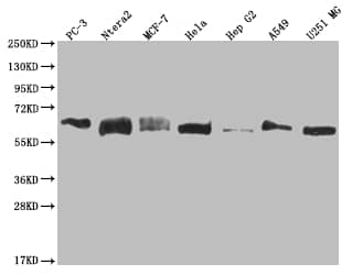 Western Blot: USP14 Antibody (28C4) [NBP3-26262] - Positive Western Blot detected in: PC3 whole cell lysate, Ntera-2 whole cell lysate, MCF-7 whole cell lysate, Hela whole cell lysate, HepG2 whole cell lysate, A549 whole cell lysate, U251 whole cell lysate. All lanes: USP14 Antibody at 1: 2000 Secondary: Goat polyclonal to rabbit IgG at 1/50000 dilution. Predicted band size: 57, 53, 55 kDa Observed band size: 55-72 kDa