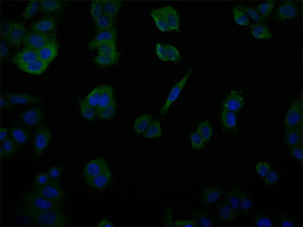 Immunocytochemistry/Immunofluorescence: USP14 Antibody (28C4) [NBP3-26262] - Staining of PC-3 cell with USP14 Antibody (28C4) at 1:50, counter-stained with DAPI. The cells were fixed in 4% formaldehyde and blocked in 10% normal Goat Serum. The cells were then incubated with the antibody overnight at 4C. The secondary antibody was Alexa Fluor 517-conjugated Goat Anti-Rabbit IgG (H+L).