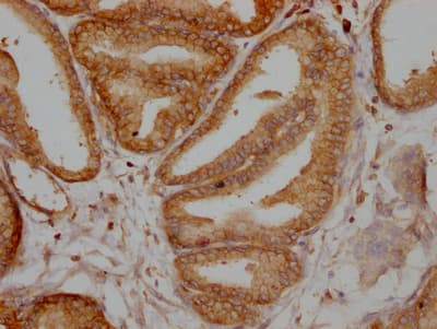 Immunohistochemistry: TPT1/TCTP Antibody (10A9) [NBP3-26272] - Image of TPT1/TCTP Antibody (10A9) diluted at 1:100 and staining in paraffin-embedded human prostate tissue performed. After dewaxing and hydration, antigen retrieval was mediated by high pressure in a citrate buffer (pH 6.0). Section was blocked with 10% normal goat serum 30min at RT. Then primary antibody (1% BSA) was incubated at 4C overnight. The primary is detected by a Goat anti-rabbit IgG polymer labeled by HRP and visualized using 0.05% DAB.