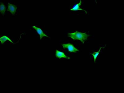 Immunocytochemistry/Immunofluorescence: TPT1/TCTP Antibody (10A9) [NBP3-26272] - Staining of SY5Y Cells with TPT1/TCTP Antibody (10A9) at 1:50, counter-stained with DAPI. The cells were fixed in 4% formaldehyde, permeated by 0.2% Triton X-100, and blocked in 10% normal Goat Serum. The cells were then incubated with the antibody overnight at 4C. Nuclear DNA was labeled in blue with DAPI. The secondary antibody was FITC-conjugated Goat Anti-Rabbit IgG (H+L).